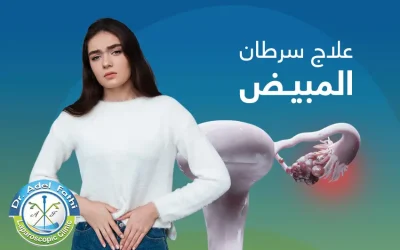 علاج سرطان المبيض المتقدم