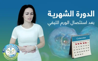هل اضطرابات الدورة الشهرية بعد استئصال الورم الليفي طبيعية؟