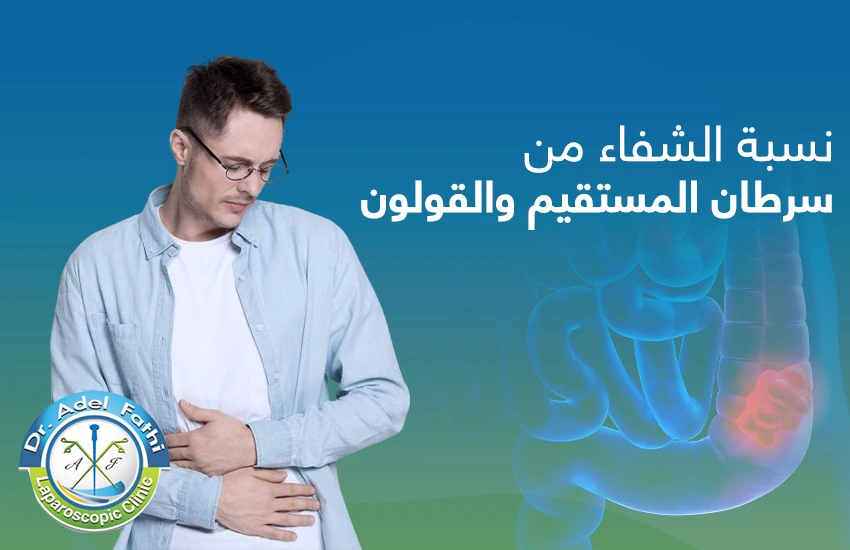 نسبة الشفاء من سرطان المستقيم نسبة الشفاء من سرطان المستقيم