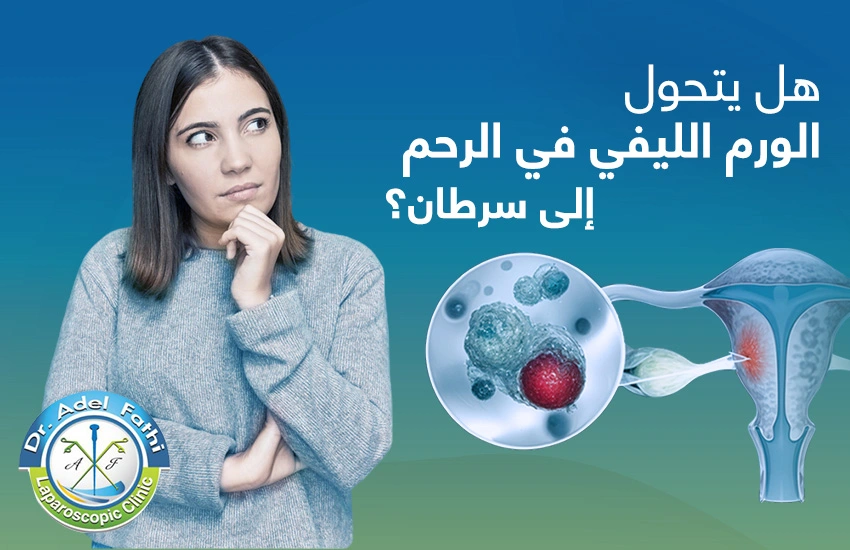 هل يتحول الورم الليفي في الرحم إلى سرطان هل يتحول الورم الليفي في الرحم إلى سرطان