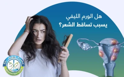هل الورم الليفي يسبب تساقط الشعر؟