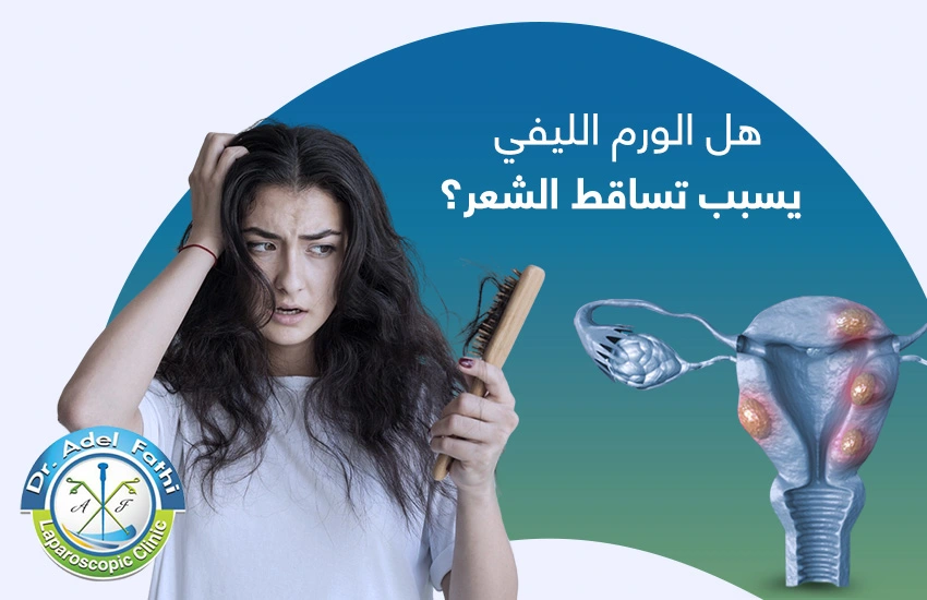 هل الورم الليفي يسبب تساقط الشعر هل الورم الليفي يسبب تساقط الشعر