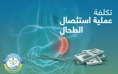 العوامل المؤثرة في تكلفة عملية استئصال الطحال بالمنظار