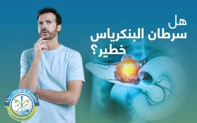 هل سرطان البنكرياس خطير؟