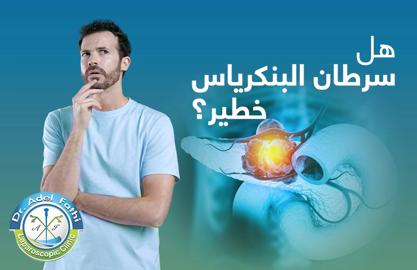 هل سرطان البنكرياس خطير