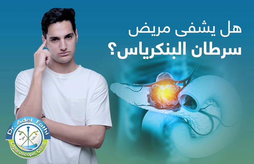 هل يشفى مريض سرطان البنكرياس