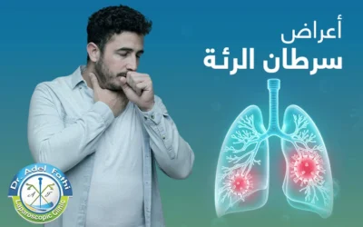 ما هي أعراض سرطان الرئة في مختلف مراحله؟
