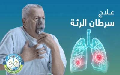 أحدث طرق تشخيص وعلاج سرطان الرئة