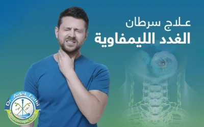 أحدث وسائل علاج سرطان الغدد الليمفاوية