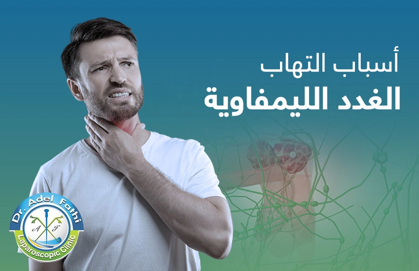 أسباب التهاب الغدد الليمفاوية