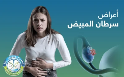 أعراض سرطان المبيض: متى يجب القلق واستشارة الطبيب؟