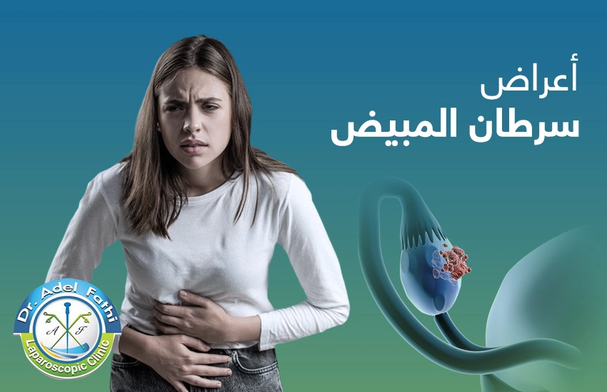 اعراض-سرطان-المبيض أعراض سرطان المبيض
