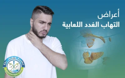 تعرف إلى أعراض التهاب الغدد اللعابية بالتفصيل