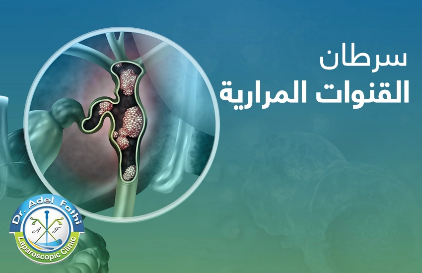 سرطان القنوات المرارية