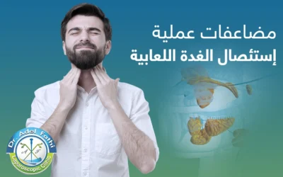 مضاعفات عملية استئصال الغدة اللعابية: دليل شامل للمخاطر المحتملة
