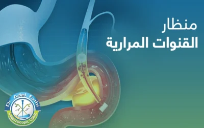 فيمّ يستخدم منظار القنوات المرارية؟