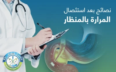 نصائح بعد استئصال المرارة بالمنظار تساعد على الشفاء