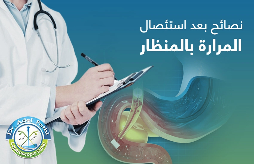 نصائح بعد استئصال المرارة بالمنظار