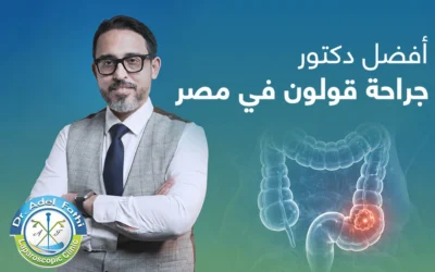 معايير اختيار أفضل دكتور جراحة قولون في مصر