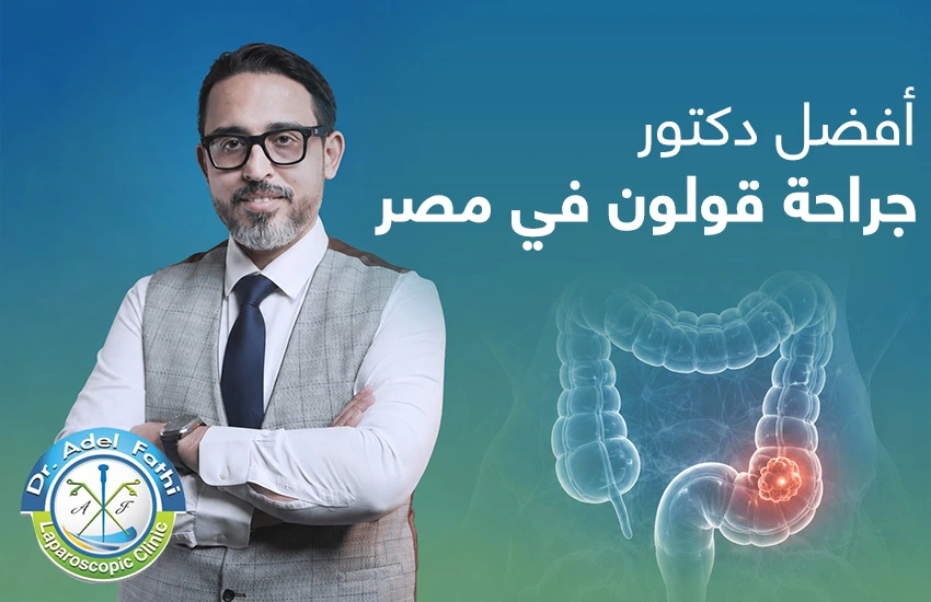 أفضل دكتور جراحة قولون في مصر