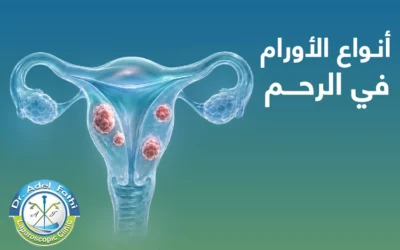 ما أنواع الأورام في الرحم
