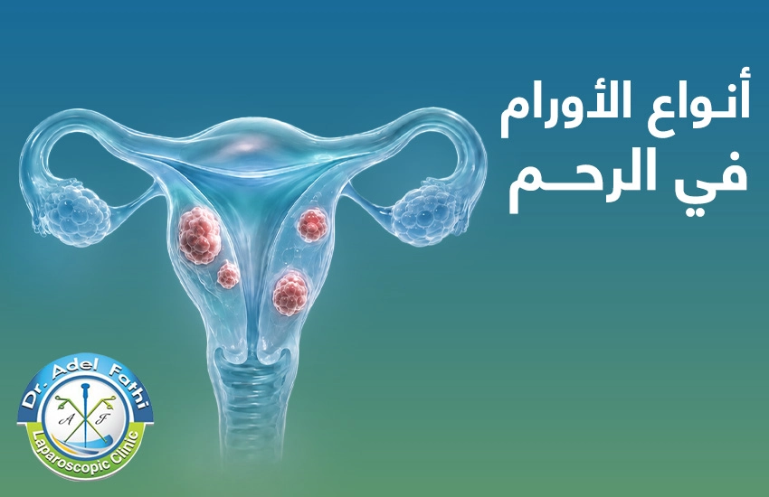 انوان-الاورام-في-الرحم أنواع الأورام في الرحم