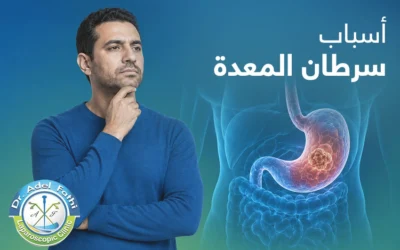 تعرف إلى أسباب سرطان المعدة