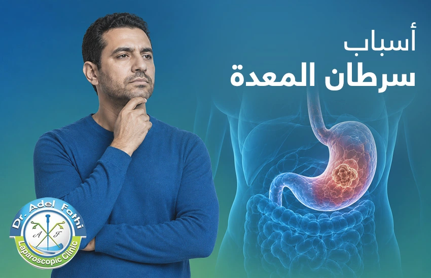 أسباب سرطان المعدة