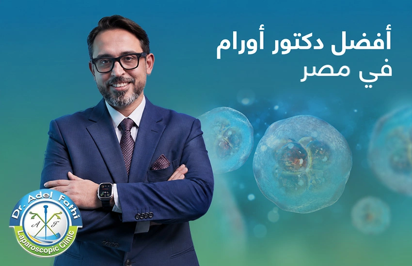 أفضل دكتور أورام في مصر