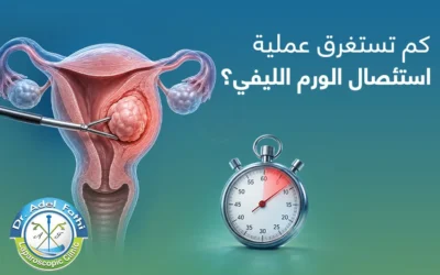 كم تستغرق عملية استئصال الورم الليفي؟